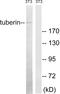 TSC Complex Subunit 2 antibody, LS-C118379, Lifespan Biosciences, Western Blot image 