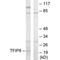 TNF Alpha Induced Protein 8 antibody, PA5-49778, Invitrogen Antibodies, Western Blot image 