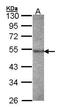 Cathepsin F antibody, GTX103095, GeneTex, Western Blot image 