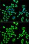 Hypoxanthine Phosphoribosyltransferase 1 antibody, GTX33248, GeneTex, Immunofluorescence image 