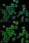 Hypoxanthine Phosphoribosyltransferase 1 antibody, GTX33248, GeneTex, Immunofluorescence image 