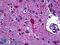 Glutamate Decarboxylase 1 antibody, LS-B5660, Lifespan Biosciences, Immunohistochemistry paraffin image 