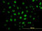 CAMP Responsive Element Binding Protein 5 antibody, LS-C133595, Lifespan Biosciences, Immunofluorescence image 