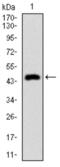 Keratin 5 antibody, abx015823, Abbexa, Western Blot image 