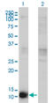 Cystatin-beta antibody, LS-B6074, Lifespan Biosciences, Western Blot image 