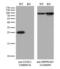 Ubiquitin C-Terminal Hydrolase L1 antibody, LS-C797038, Lifespan Biosciences, Western Blot image 