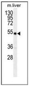 Growth Differentiation Factor 6 antibody, AP51812PU-N, Origene, Western Blot image 