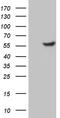 Transcription Factor Dp-2 antibody, M06850, Boster Biological Technology, Western Blot image 