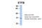 Electron transfer flavoprotein subunit beta antibody, 30-973, ProSci, Western Blot image 