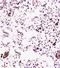 DNA Methyltransferase 1 antibody, orb10546, Biorbyt, Immunohistochemistry paraffin image 