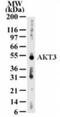 RAC-gamma serine/threonine-protein kinase antibody, GTX13919, GeneTex, Western Blot image 