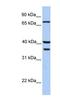 Transglutaminase 5 antibody, NBP1-54329, Novus Biologicals, Western Blot image 