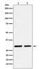 Distal-Less Homeobox 5 antibody, M02523, Boster Biological Technology, Western Blot image 