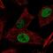 Alpha-1,6-Mannosylglycoprotein 6-Beta-N-Acetylglucosaminyltransferase B antibody, NBP2-58992, Novus Biologicals, Immunofluorescence image 