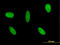 GLI Family Zinc Finger 3 antibody, LS-C197308, Lifespan Biosciences, Immunofluorescence image 