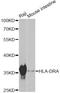 Major Histocompatibility Complex, Class II, DR Alpha antibody, A11790, ABclonal Technology, Western Blot image 