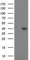 Sulfotransferase Family 1C Member 2 antibody, TA502694, Origene, Western Blot image 