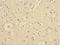 RNF36 antibody, LS-C682145, Lifespan Biosciences, Immunohistochemistry paraffin image 