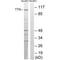 TTK Protein Kinase antibody, A01132, Boster Biological Technology, Western Blot image 