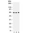 Folate transporter 1 antibody, R32093, NSJ Bioreagents, Western Blot image 