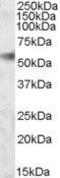 SH2 Domain Containing 4A antibody, GTX88504, GeneTex, Western Blot image 