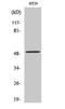 Zinc finger FYVE domain-containing protein 19 antibody, STJ96307, St John