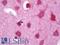 Huntingtin antibody, LS-B11011, Lifespan Biosciences, Immunohistochemistry frozen image 