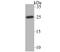 Calcium Voltage-Gated Channel Auxiliary Subunit Gamma 1 antibody, NBP2-76917, Novus Biologicals, Western Blot image 