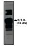 Kv3.1b Potassium Channel antibody, orb108848, Biorbyt, Western Blot image 