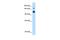 GTPase Activating Protein And VPS9 Domains 1 antibody, PA5-42180, Invitrogen Antibodies, Western Blot image 