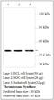 Thromboxane A Synthase 1 antibody, MBS415470, MyBioSource, Western Blot image 