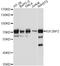 Insulin Like Growth Factor 2 MRNA Binding Protein 2 antibody, A1774, ABclonal Technology, Western Blot image 