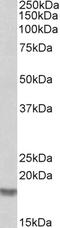 Cofilin 2 antibody, EB06889, Everest Biotech, Western Blot image 