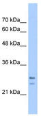 SRP Receptor Subunit Beta antibody, TA338466, Origene, Western Blot image 