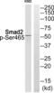 SMAD2 antibody, abx012740, Abbexa, Western Blot image 