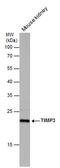 TIMP Metallopeptidase Inhibitor 3 antibody, PA5-78423, Invitrogen Antibodies, Western Blot image 