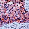Junction Plakoglobin antibody, PA5-32295, Invitrogen Antibodies, Immunohistochemistry paraffin image 