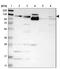 Integrin Subunit Alpha 7 antibody, NBP1-86118, Novus Biologicals, Western Blot image 