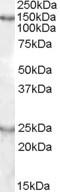 Dyslexia-associated protein KIAA0319 homolog antibody, NB100-93472, Novus Biologicals, Western Blot image 