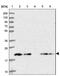 Transmembrane P24 Trafficking Protein 10 antibody, NBP2-47600, Novus Biologicals, Western Blot image 