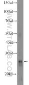 Glutathione peroxidase 3 antibody, 13947-1-AP, Proteintech Group, Western Blot image 