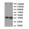 Annexin A10 antibody, LS-C313197, Lifespan Biosciences, Western Blot image 