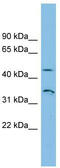 Rh Family B Glycoprotein (Gene/Pseudogene) antibody, TA338416, Origene, Western Blot image 