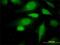 Arginyltransferase 1 antibody, H00011101-M01, Novus Biologicals, Immunocytochemistry image 
