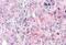 Olfactory receptor 2A4 antibody, NLS3903, Novus Biologicals, Immunohistochemistry paraffin image 