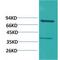 Phosphoinositide-3-Kinase Regulatory Subunit 1 antibody, LS-C387815, Lifespan Biosciences, Western Blot image 