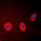 Keratin 17 antibody, LS-B16078, Lifespan Biosciences, Immunofluorescence image 