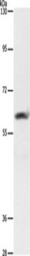 Apoptosis Inducing Factor Mitochondria Associated 3 antibody, TA349675, Origene, Western Blot image 