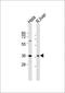 Paired Box 4 antibody, GTX81771, GeneTex, Western Blot image 