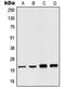 NADH:Ubiquinone Oxidoreductase Subunit B10 antibody, LS-C352560, Lifespan Biosciences, Western Blot image 